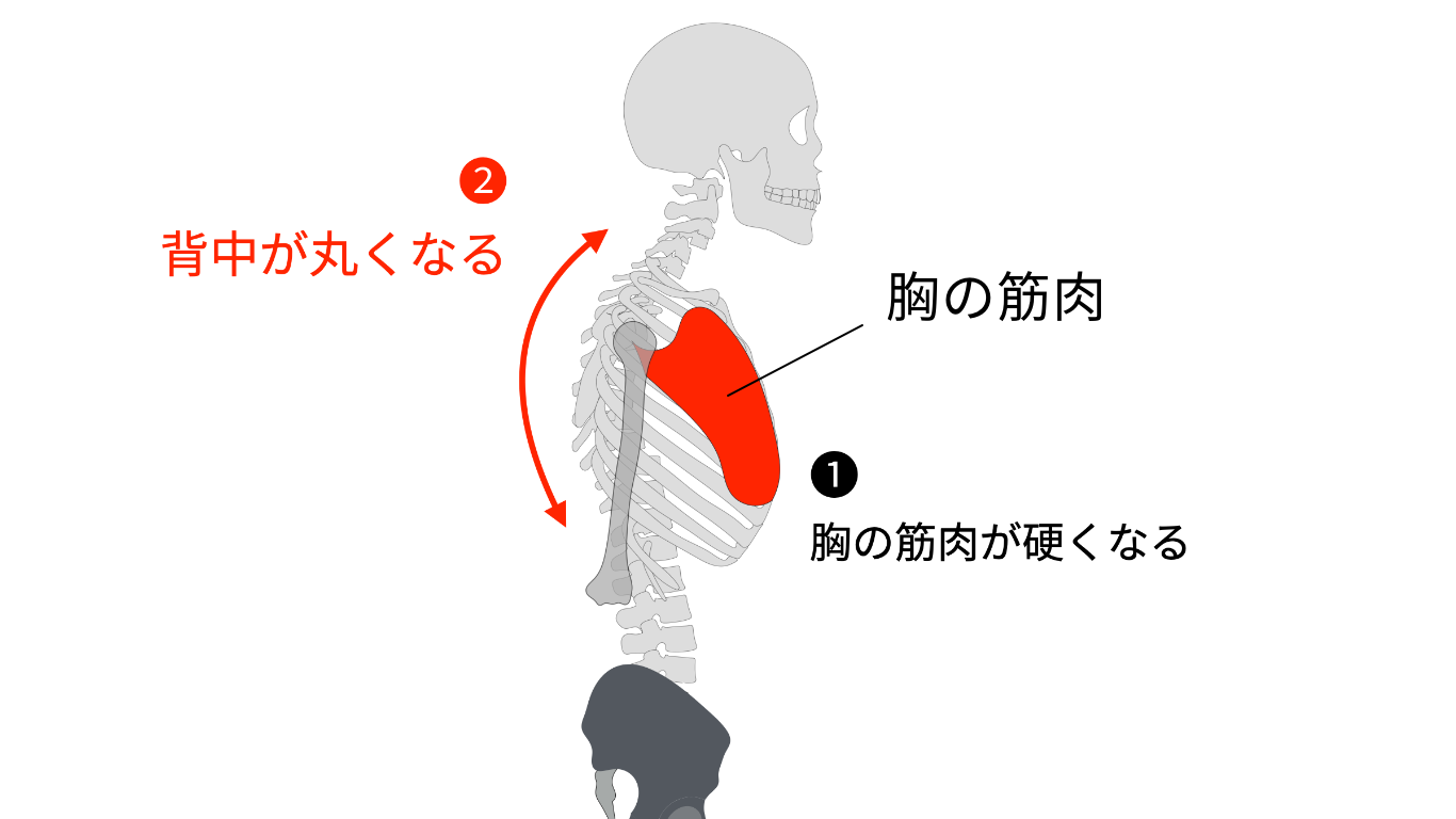 胸が硬くなる　胸椎後弯